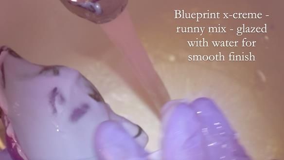 Finlay's Newsletter 62 provision of extractions and metal based complete dentures for Rafique