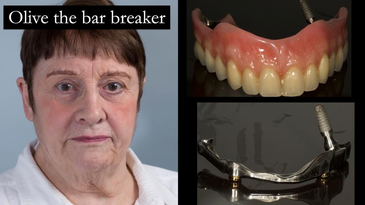 Newsletter 87 – Father Peter: A Partial Denture that needed Minor Miracle