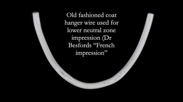 Newsletter 83: Sheila’s Complete Denture Success