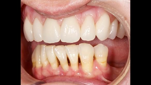 Newsletter 79 – Creating a wonderful smile and changing a life.