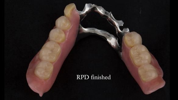 Ken – going downhill, first class