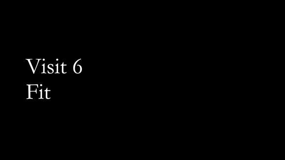 Finlay's Newsletter 59 Ultra hard partial dentures made for Gill