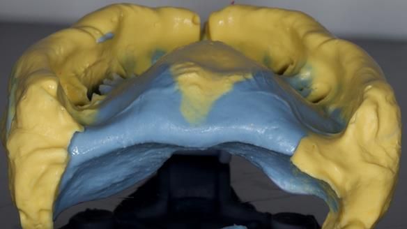 Newsletter 79 – Creating a wonderful smile and changing a life.