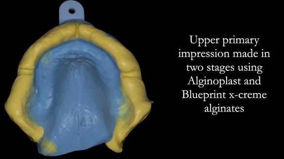 Newsletter 50 Special edition Complete Dentures FULL PROTOCOL