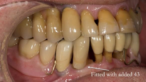 Ken – going downhill, first class