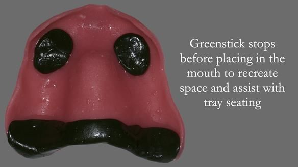 Finlay's Newsletter 62 provision of extractions and metal based complete dentures for Rafique