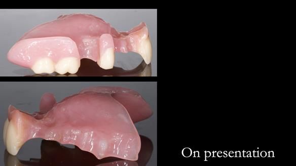 Newsletter 79 – Creating a wonderful smile and changing a life.