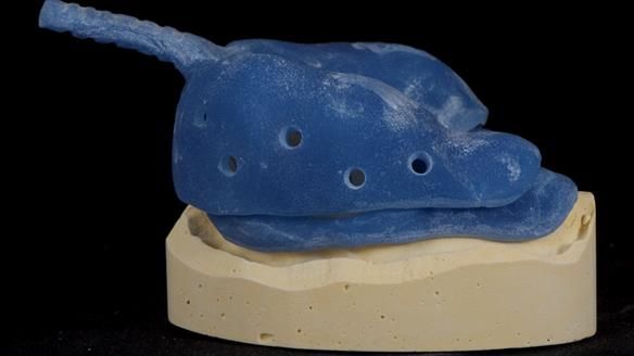 Newsletter 79 – Creating a wonderful smile and changing a life.