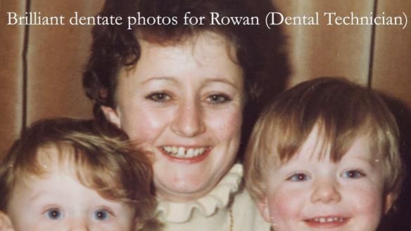 Solving Linda’s Failed “All on 4” implant bridges - full protocol Newsletter 42