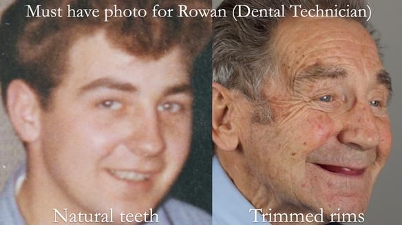 Newsletter 50 Special edition Complete Dentures FULL PROTOCOL