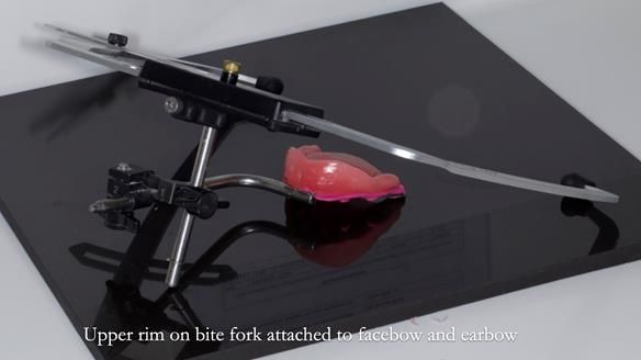 Newsletter 83: Sheila’s Complete Denture Success