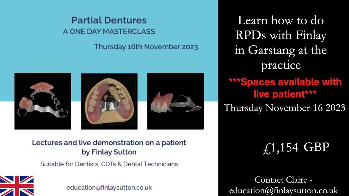 Newsletter 56 showing the making and fitting of a bilateral free end saddle upper removable partial denture (RPD) for patient with pemphigus