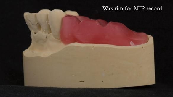 Ken – going downhill, first class