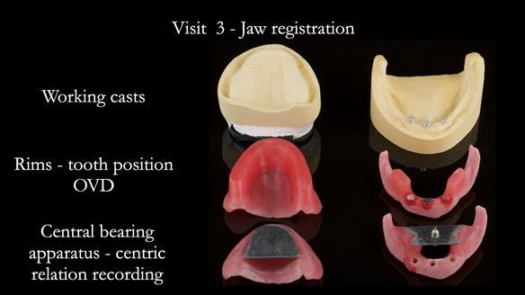 Technical work provided by Rowan for treatment visit 3