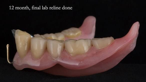 Ken – going downhill, first class