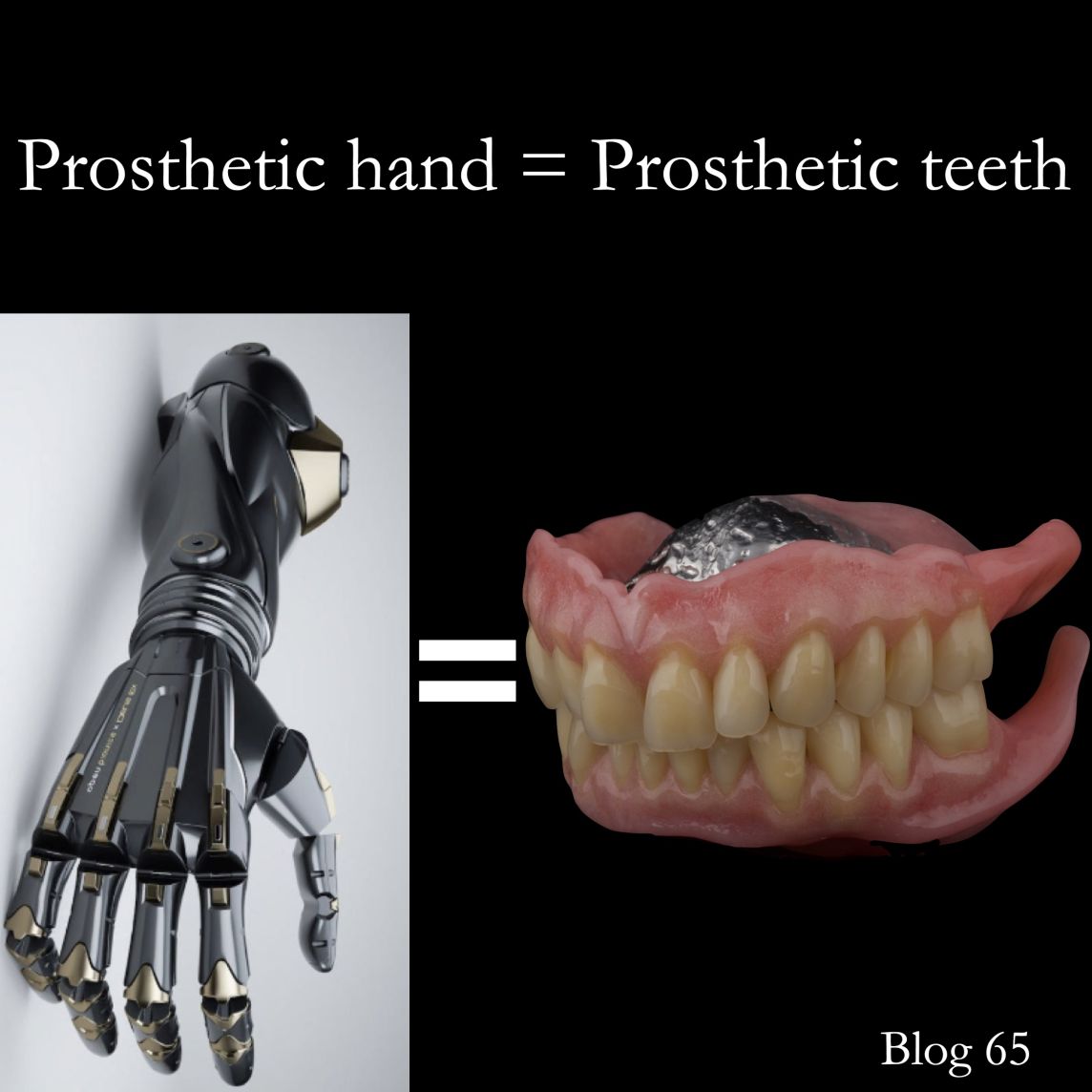 Dentures work in a similar way to a prosthetic hand