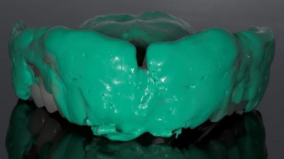 Newsletter 79 – Creating a wonderful smile and changing a life.