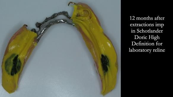 Ken – going downhill, first class