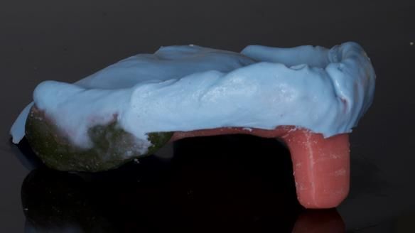 Newsletter 79 – Creating a wonderful smile and changing a life.