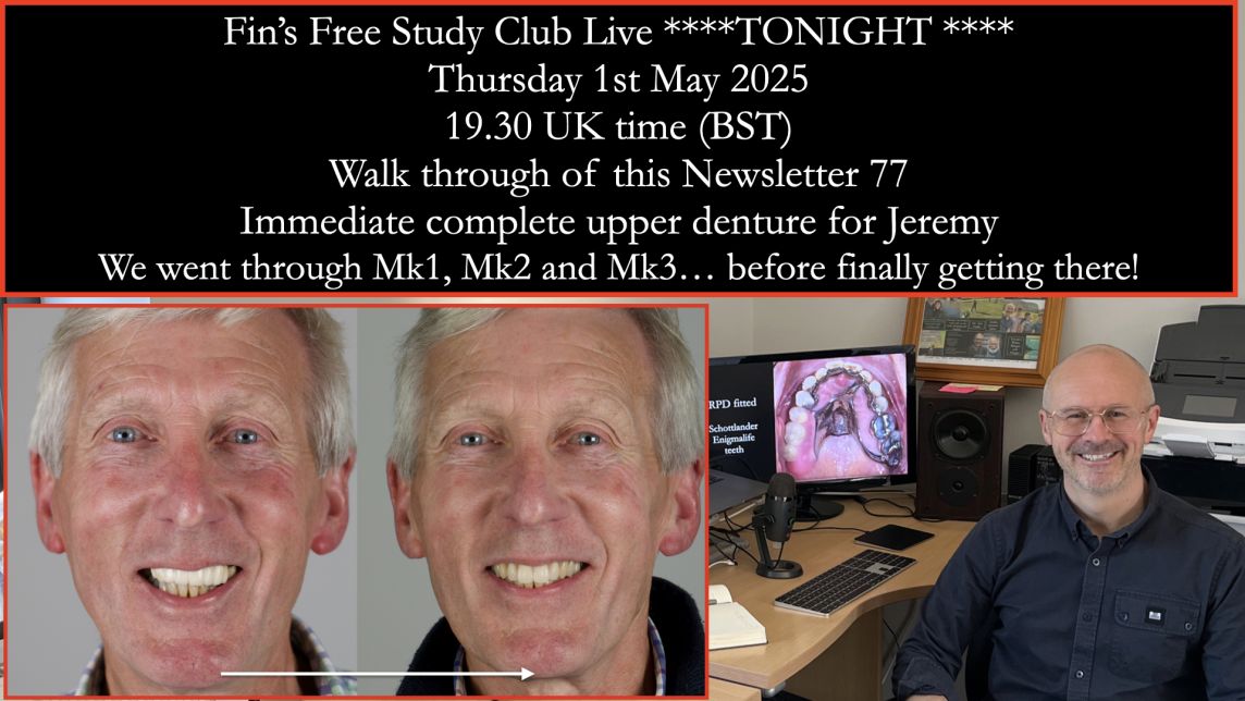 Solving Speech Challenges with Complete Dentures – Jeremy’s 20-Month Journey