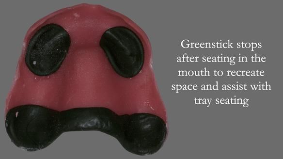 Newsletter 50 Special edition Complete Dentures FULL PROTOCOL