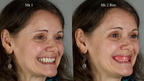 Newsletter 79 – Creating a wonderful smile and changing a life.