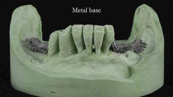 Ken – going downhill, first class