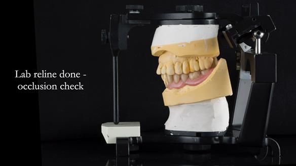 Ken – going downhill, first class