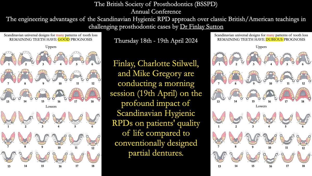 Finlay's Newsletter 61 provision of a lower unilateral free end saddle metal based partial denture for Joyce
