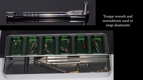 Newsletter 78: What do Clark Gable and a Locator® overdenture have in common?