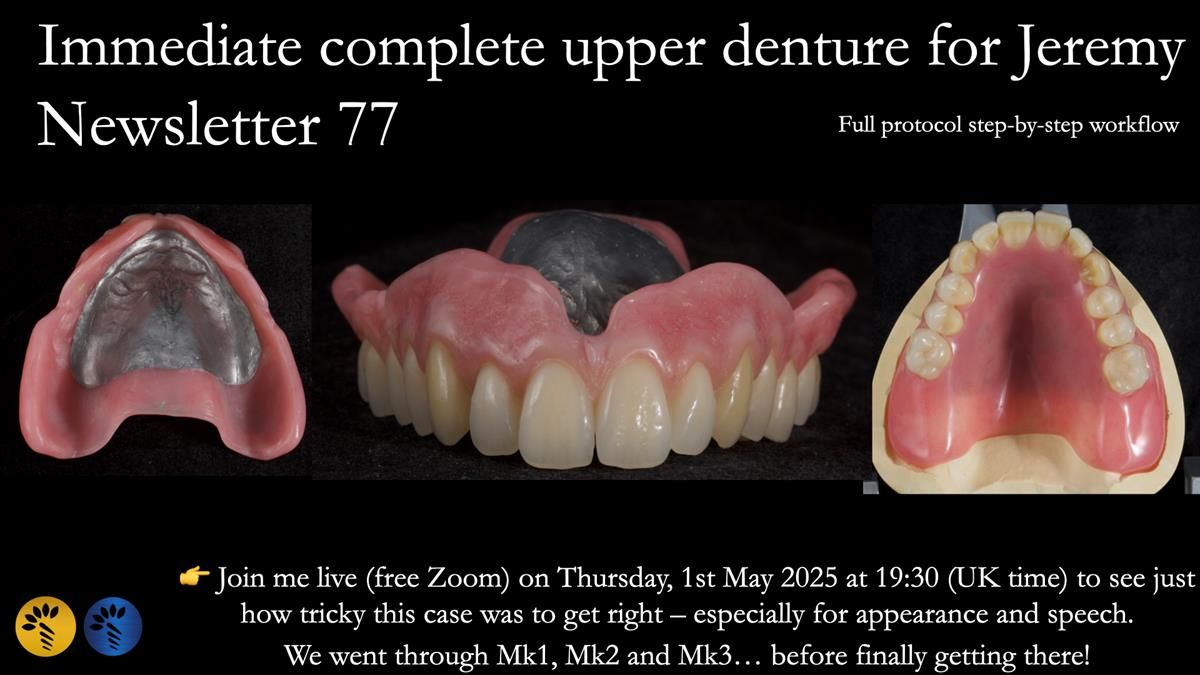 Newsletter 77: Jeremy’s case – immediate complete upper denture