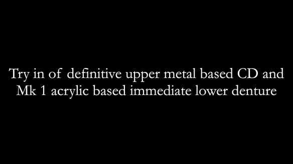 Newsletter 82 Mary - A complete upper and a one-tooth gasket denture