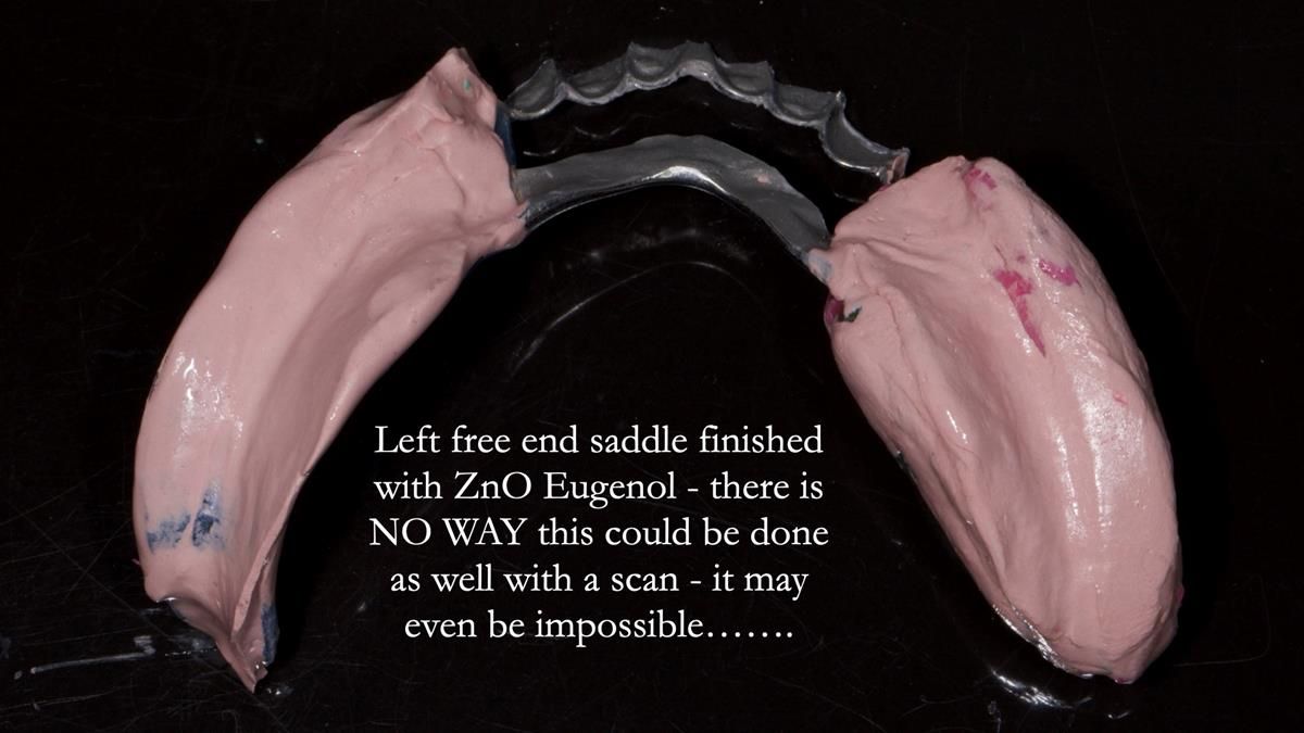 Newsletter 87 – Father Peter: A Partial Denture that needed Minor Miracle