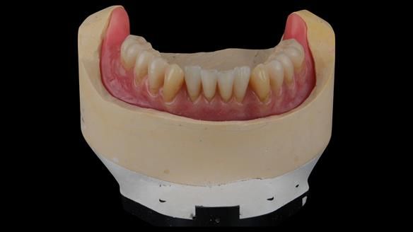 Newsletter 50 Special edition Complete Dentures FULL PROTOCOL