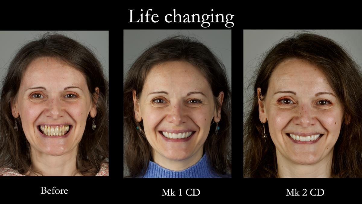 Newsletter 79 – Creating a wonderful smile and changing a life.