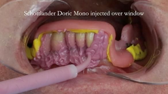 Ken – going downhill, first class