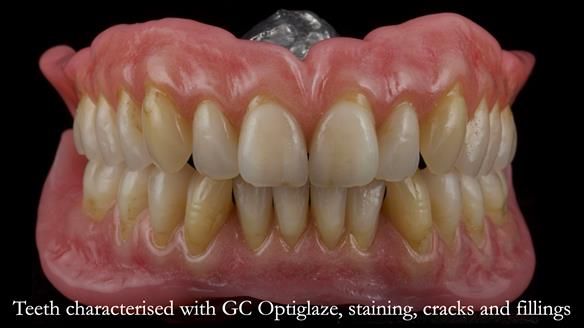 Newsletter 50 Special edition Complete Dentures FULL PROTOCOL