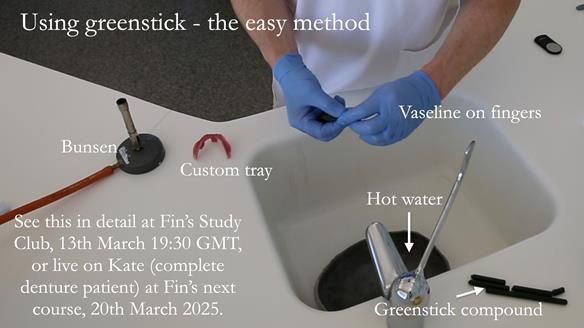 Newsletter 75: Marion’s case - Step-by-step complete denture workflow