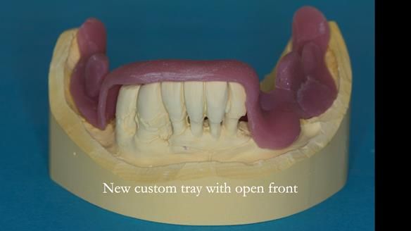 Ken – going downhill, first class