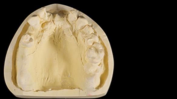 Newsletter 79 – Creating a wonderful smile and changing a life.