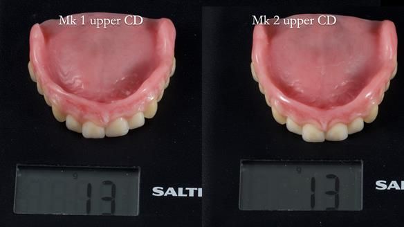 Newsletter 83: Sheila’s Complete Denture Success