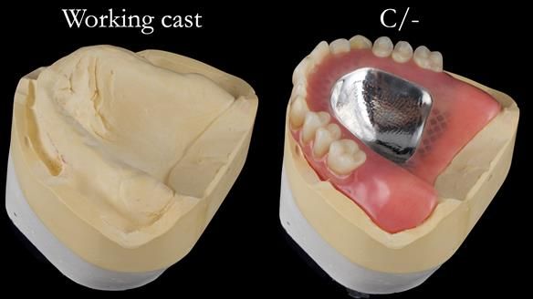 Newsletter 50 Special edition Complete Dentures FULL PROTOCOL