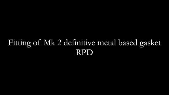Newsletter 82 Mary - A complete upper and a one-tooth gasket denture