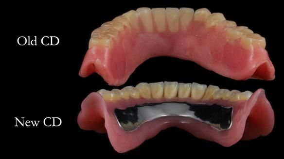 Finlay's Newsletter 62 provision of extractions and metal based complete dentures for Rafique