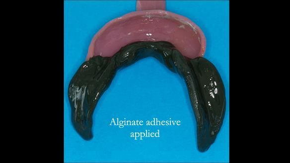 Ken – going downhill, first class