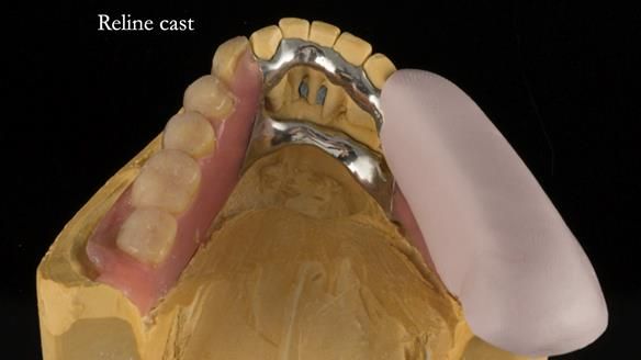 Ken – going downhill, first class