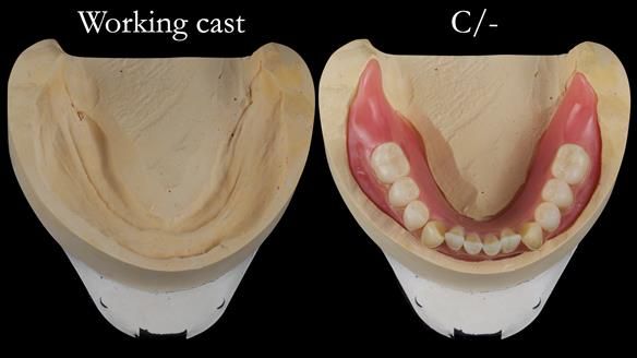 Newsletter 50 Special edition Complete Dentures FULL PROTOCOL