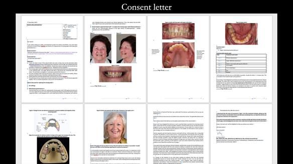 Finlay's Newsletter 60 Sylvia's upper Kennedy Class 2 Mod 1 metal based upper RPD