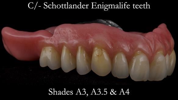 Newsletter 50 Special edition Complete Dentures FULL PROTOCOL