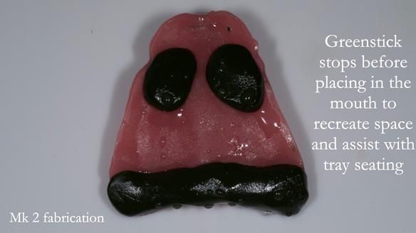 Replacing Madeline’s Complete denture FULL PROTOCOL